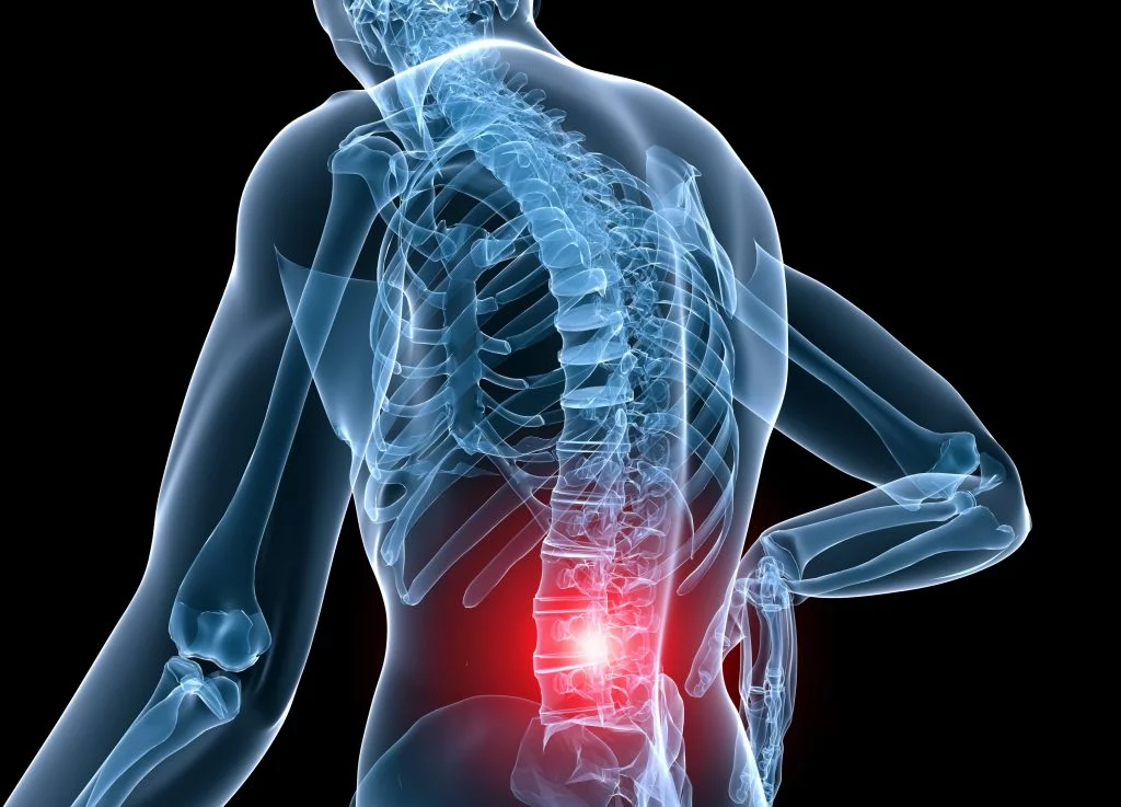 clarks summit pa chiropractor for back pain spine